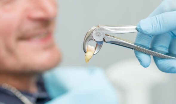 WISDOM TOOTH SURGERY 02
