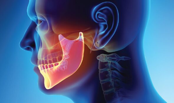 JAW TREATMENT 01